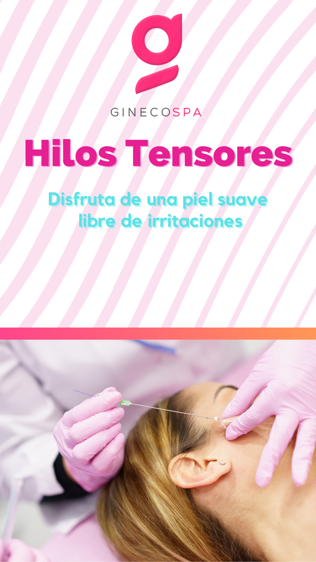 Hilos tensores