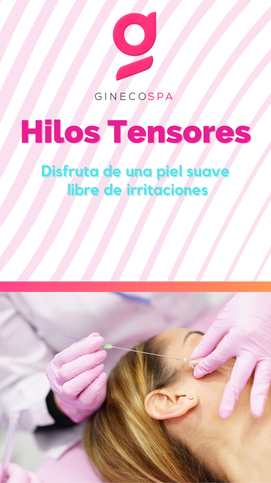 Hilos tensores