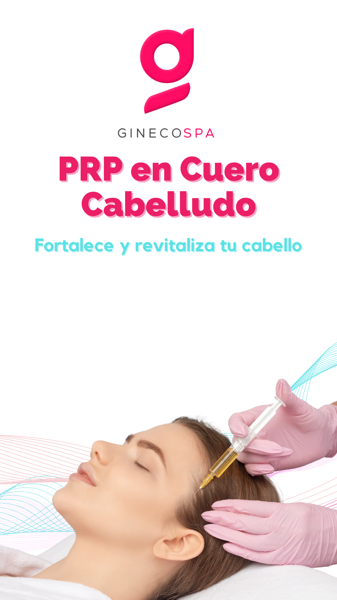 Plasma rico en plaquetas (Cuero cabelludo)
