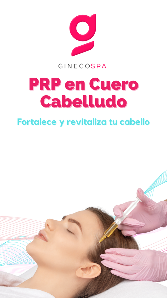 Plasma rico en plaquetas (Cuero cabelludo)