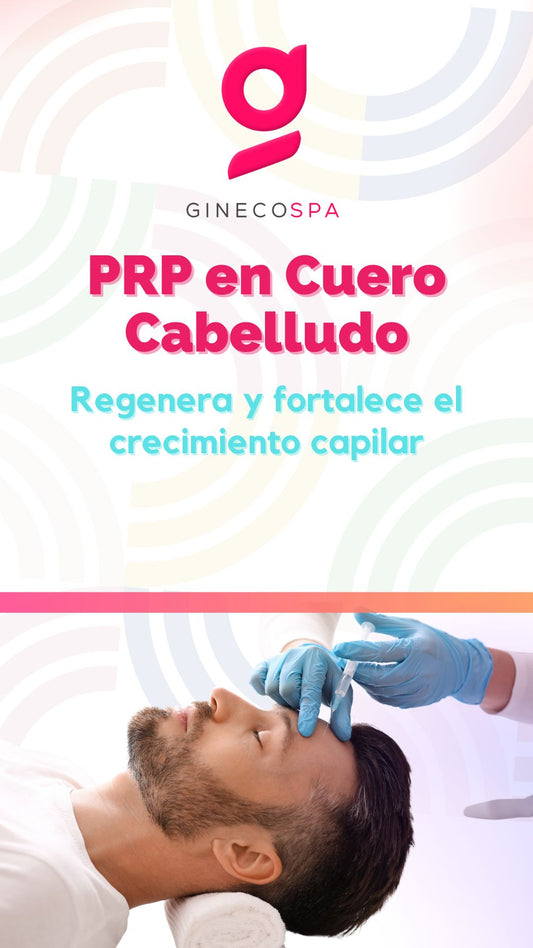 PRP en cuero cabelludo