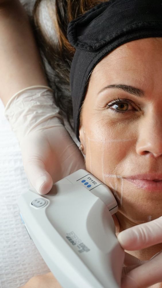 HIFU Facial 7D
