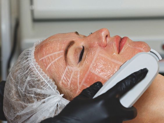 HIFU Facial 7D