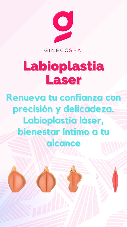 Labioplastia