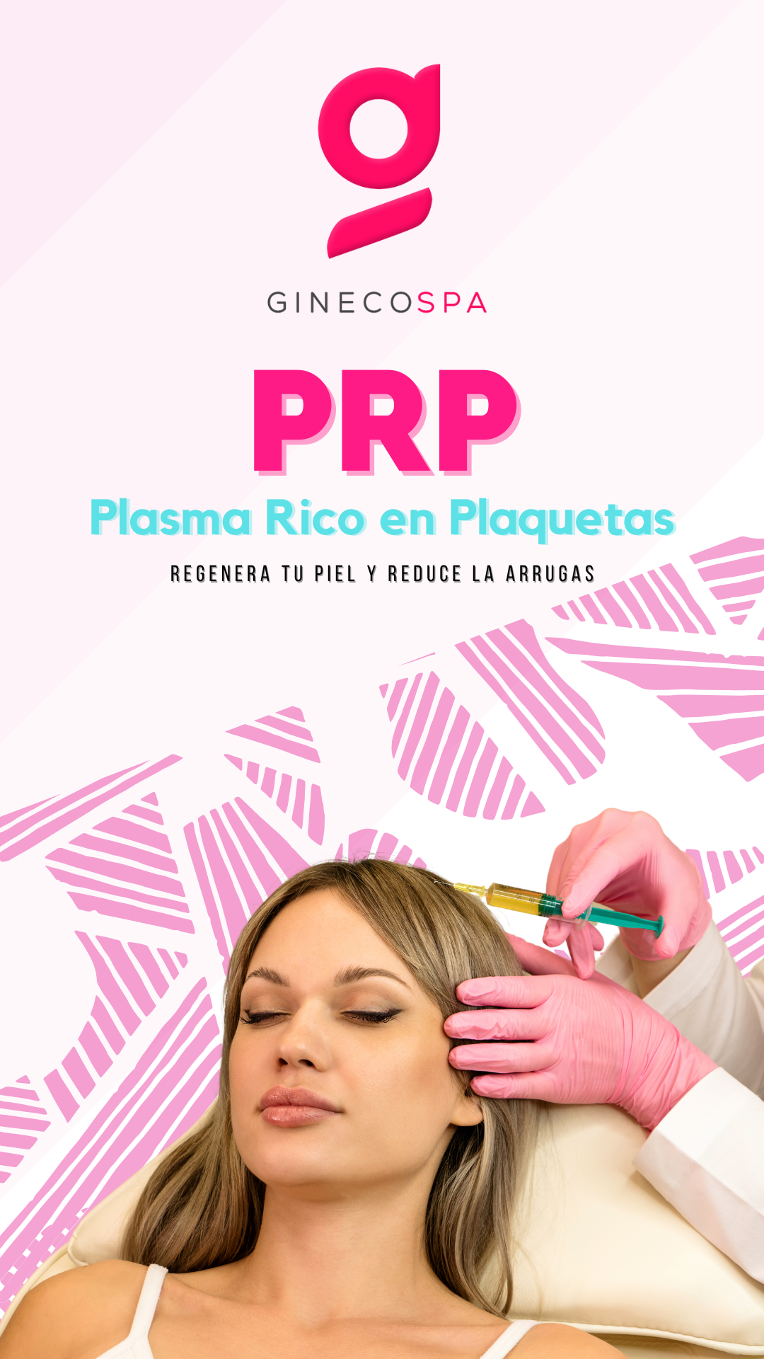 Plasma rico en plaquetas (Facial)