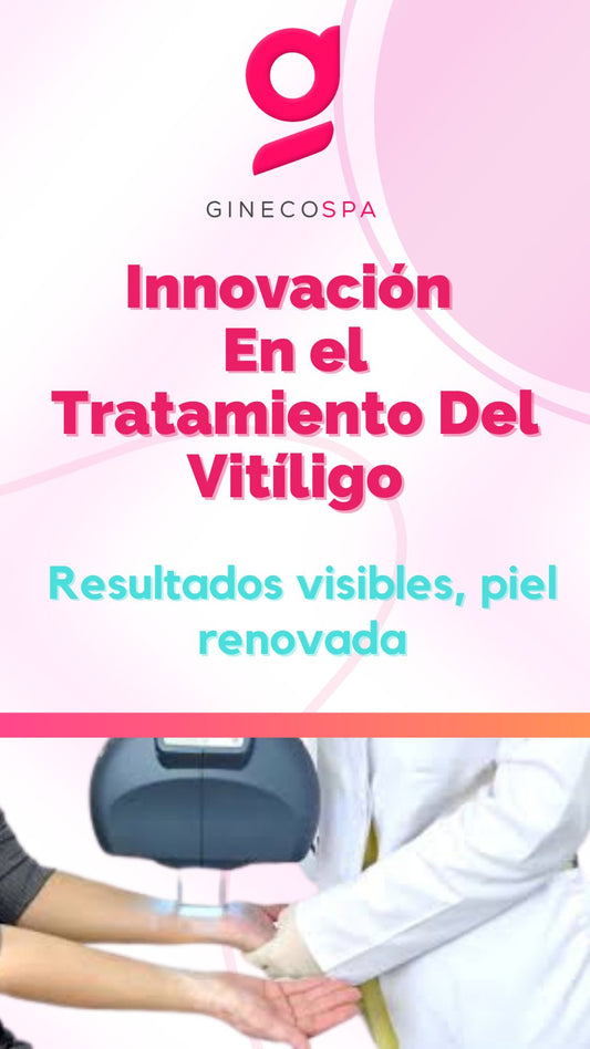 Vitiligo
